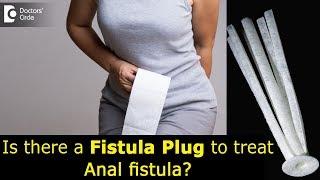 What is a Fistula Plug? Treating anal fistula with anal plug - Dr. Rajasekhar M R | Doctors' Circle