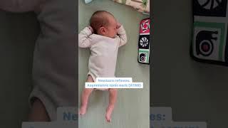 Newborn reflexes. Asymmetric Tonic Neck Reflex (ATNR) Maria Teresa Ferrer, Dr in Physical Therapy