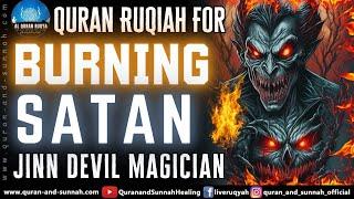 Ruqyah Shariah For Burning All Types Of Jinn, Evils And Shaytan | Burn Every Jinn And Satan To Dust.