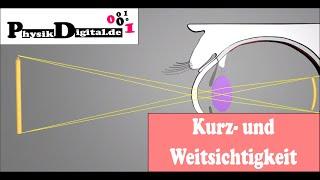 Wie kommt es zu Kurz-  und Weitsichtigkeit? - einfach und anschaulich erklärt