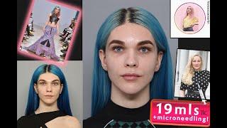 Trans Woman Non-surgical Facial Feminisation