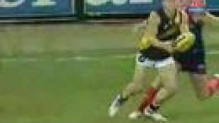 AFL Player Nathan Brown Breaks Leg