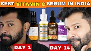 Must Watch before Buying Vitamin C Serum for Skin Brightening | Shocking Results  | Shadhik Azeez
