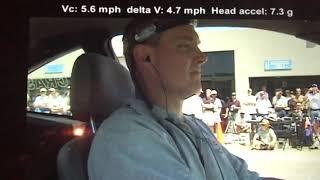 INCREDIBLE: Neck Injuries From A Rear End Collision At 5.6 MPH?