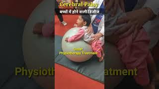 (सेरेब्रल पाल्सी) Cerebral Palsy  #physiodrdeepaksoni #cerebralpalsy