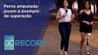 GR - Perna amputada: jovem é exemplo de superação - 23-08-2018