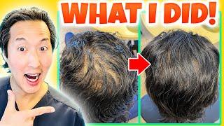 How I Treated My Thinning Hair the Holistic Way!