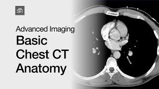 Advanced Imaging: Basic Chest CT Anatomy