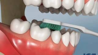 Brushing Lower Teeth