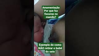 Amamentação e fissuras nos mamilos