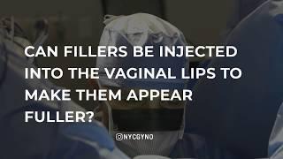 Can fillers be injected into the vaginal lips to make them appear fuller?