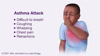 Asthmatic Bronchiole During an Exacerbation