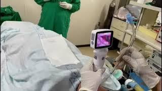 Postman video laryngoscope for airway intubation