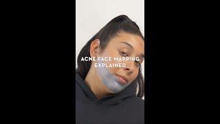 Acne Face Mapping Explained | Sonage Skincare