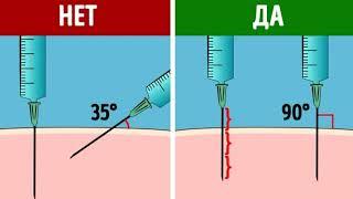  Как правильно делать укол.  Как делать укол в ягодицу.  Видео как делают уколы