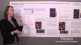 Multi-Model Tissue Imaging by DESI and MALDI Tof Mass Spectrometry Imaging