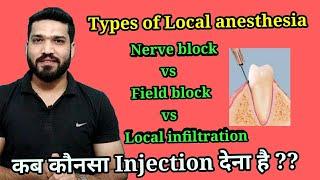 Types of Local anesthesia Injection