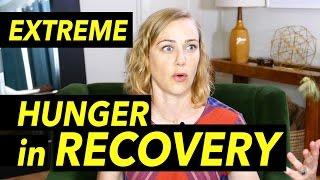 Extreme Hunger in Eating Disorder Recovery