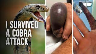 How to Survive a King Cobra Attack