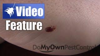 Bed Bug Bite Feeding - Time Lapsed Bed Bug Bite in HD (Bed Bug Bites)