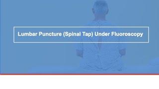 Lumbar Puncture (Spinal Tap) Under Fluoroscopy