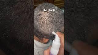 RAMBUT PANJANG DAN LEBAT DALAM 2 MINGGU !! (cek kolom komentar)