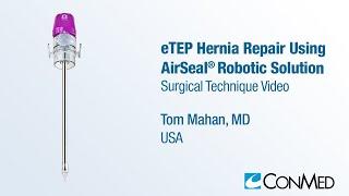 Dr. Tom Mahan - eTEP Hernia Repair Using AirSeal® Robotic Solution - CONMED Surgical Technique