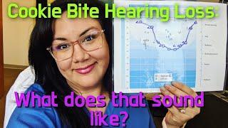 Hearing Speech With A Cookie Bite Hearing Loss | Congenital Hearing Loss Simulation