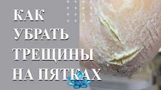 Как убрать трещины на пятках.