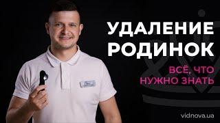 Удаление родинок: что нужно знать | клиника Vidnova