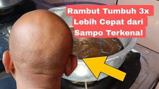 Cara Cepat Menumbuhkan Rambut 100% Alami