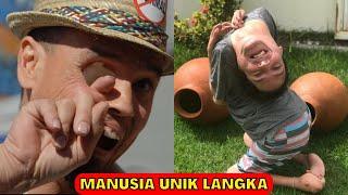 Manusia UNIK Yang LANGKA Di Dunia melawan Penyakitnya!