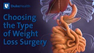 Choosing the Type of Weight Loss Surgery | Duke Health