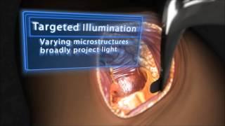 EIGR Surgical Illumination Technology from Invuity