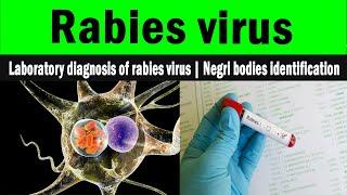 Laboratory diagnosis of rabies virus | Negri bodies identification