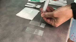 spreading of aspirate on glass slide, squash technique