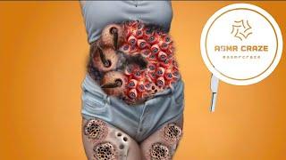 ASMR Pregnant Belly Care Animation | Removing Infections, Maggots & Worms | ASMR Craze