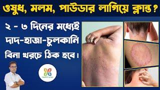 3 effective Remedies for Itching Problem In Private Parts. Skin Fungal Infection. দাদ,হাজা,চুলকানি ।