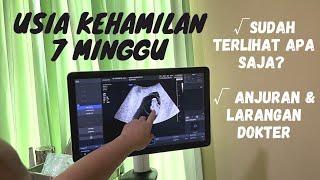 HASIL USG BAYI 7 MINGGU | USG 1-2 BULAN | USG TRIMESTER 1 | PERKEMBANGAN JANIN 7 MINGGU