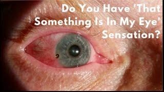 Foreign Body Sensation In Eyes - EXPLAINED! | Dr. D'Orio Eyecare