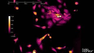 Long-term non-invasive live cell imaging of JIMT-1 cells | HoloMonitor®