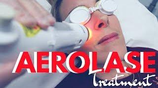 Aerolase Laser Treatment Review - Anti-Aging And Acne Skin Care