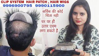 Clip system hair wigs | clip system hair patch | Hair Wigs In Delhi | Hair Wigs Shop In delhi