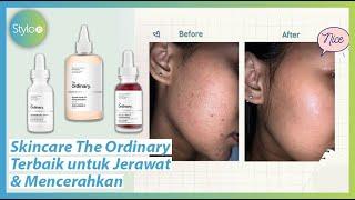 Serum & Masker Terbaik untuk Bekas Jerawat - Mencerahkan Wajah dari Skincare The Ordinary | Stylo.ID