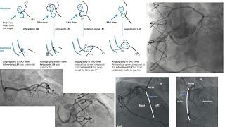 Coronary artery anomalies: angiography, case illustrations, and management- Elias Hanna