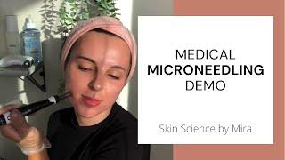 HOME MICRONEEDLING | derma roller vs pen demo | collagen induction therapy