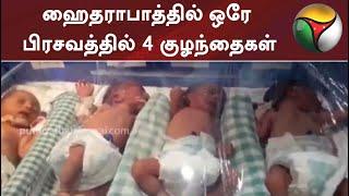 4 babies in one delivery in Hyderabad