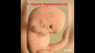 2-месяц беременности 3D