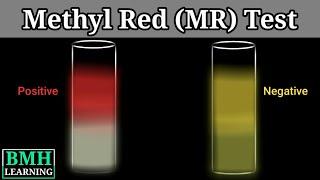 Methyl Red Test | Methyl Red Test For Identification Of Bacteria |