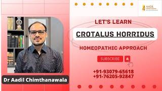 CROTALUS HORRIDUS। Homeopathic remedy। Dr Aadil Chimthanawala #youtube #video #health #cure